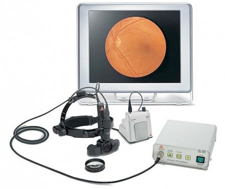 Непрямой бинокулярный офтальмоскоп Video OMEGA 2C